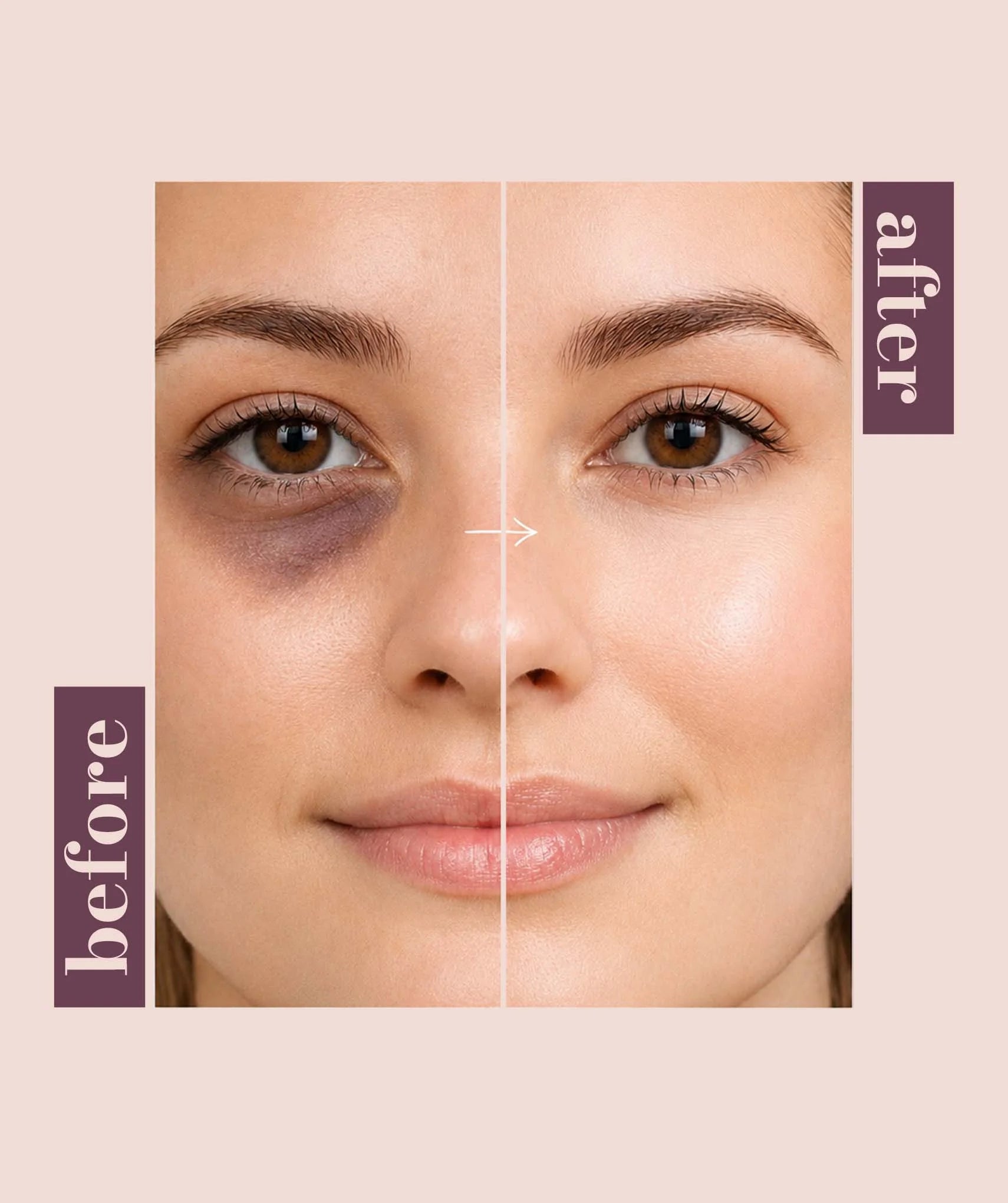 Undereye Brightening Complex