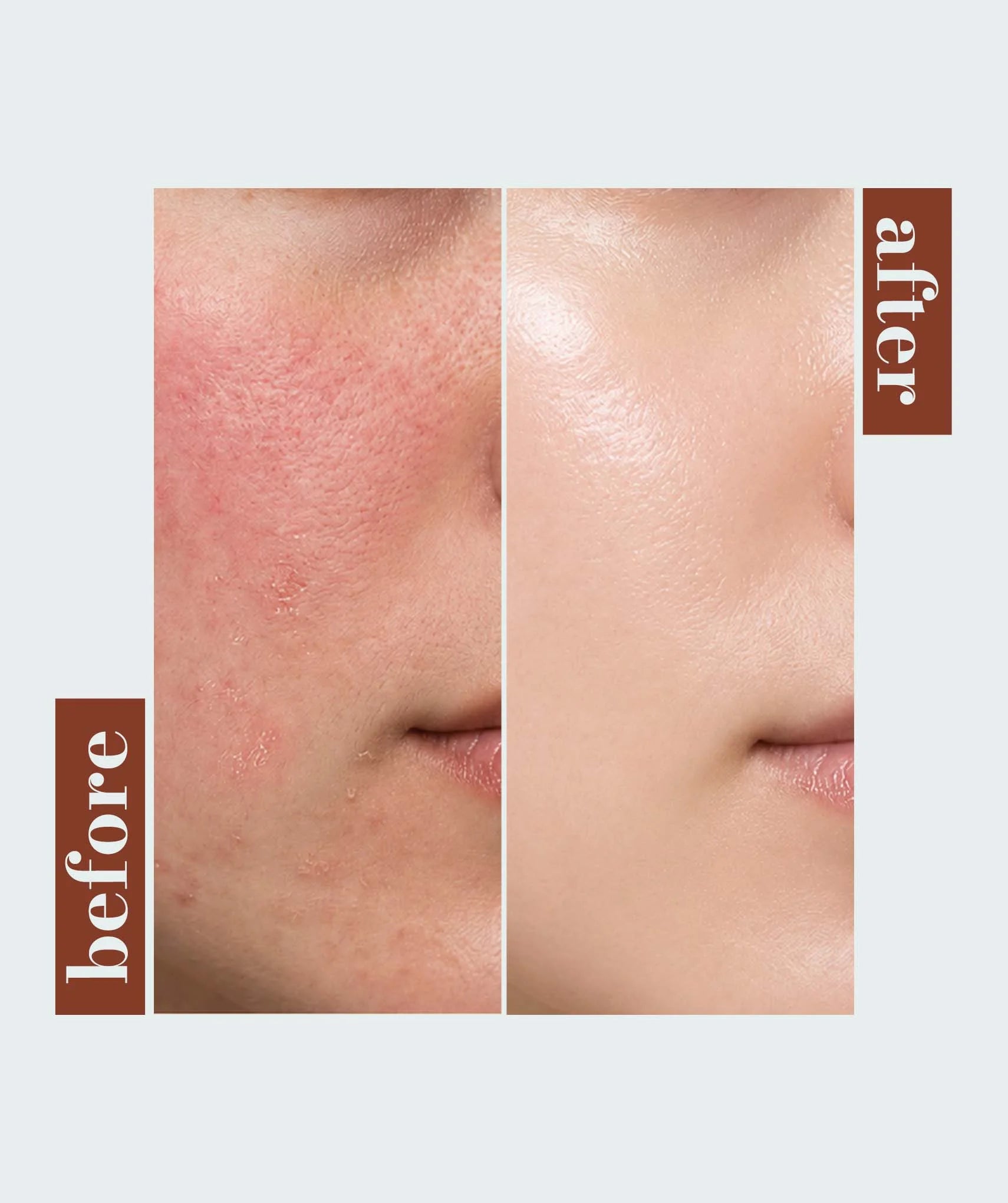 Plump & Repair Complex