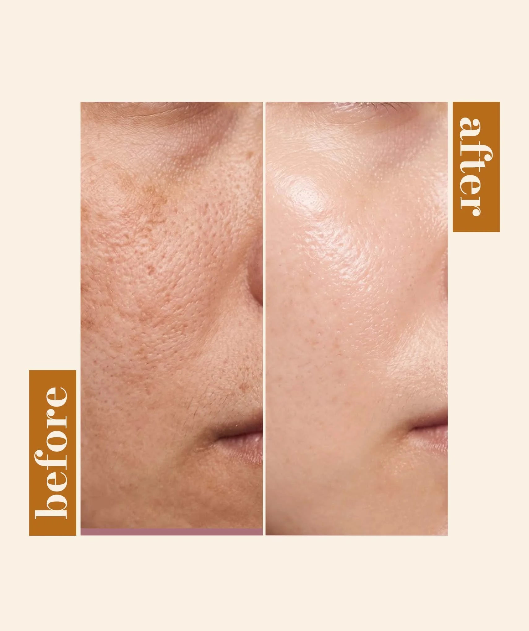 Skin Brightening Complex